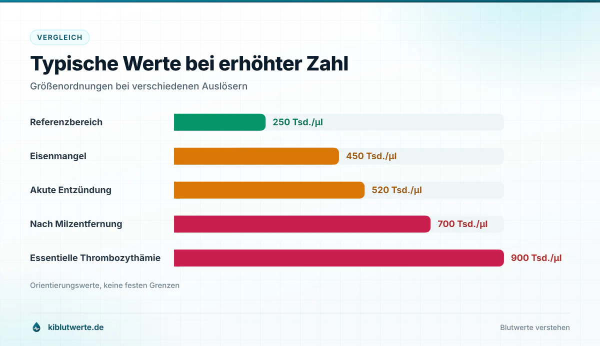 Balkendiagramm mit typischen Thrombozytenwerten bei Gesunden, Eisenmangel, akuter Entzündung, nach Milzentfernung und bei essentieller Thrombozythämie